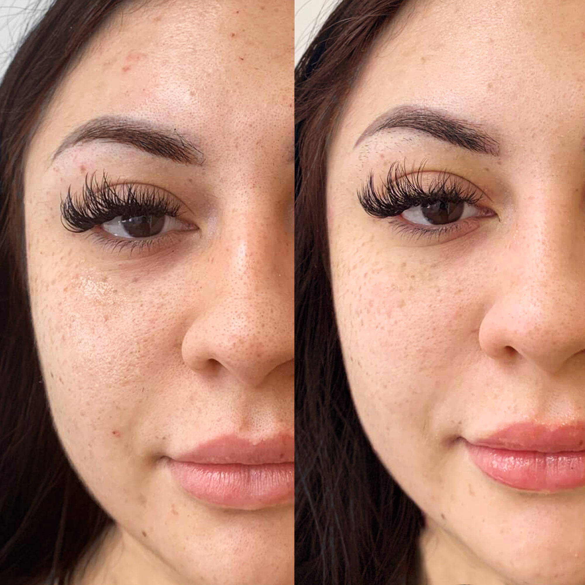 Flawless Skin Complete Kit