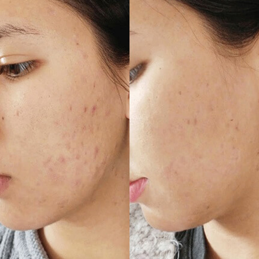 Mega Complexion Kit