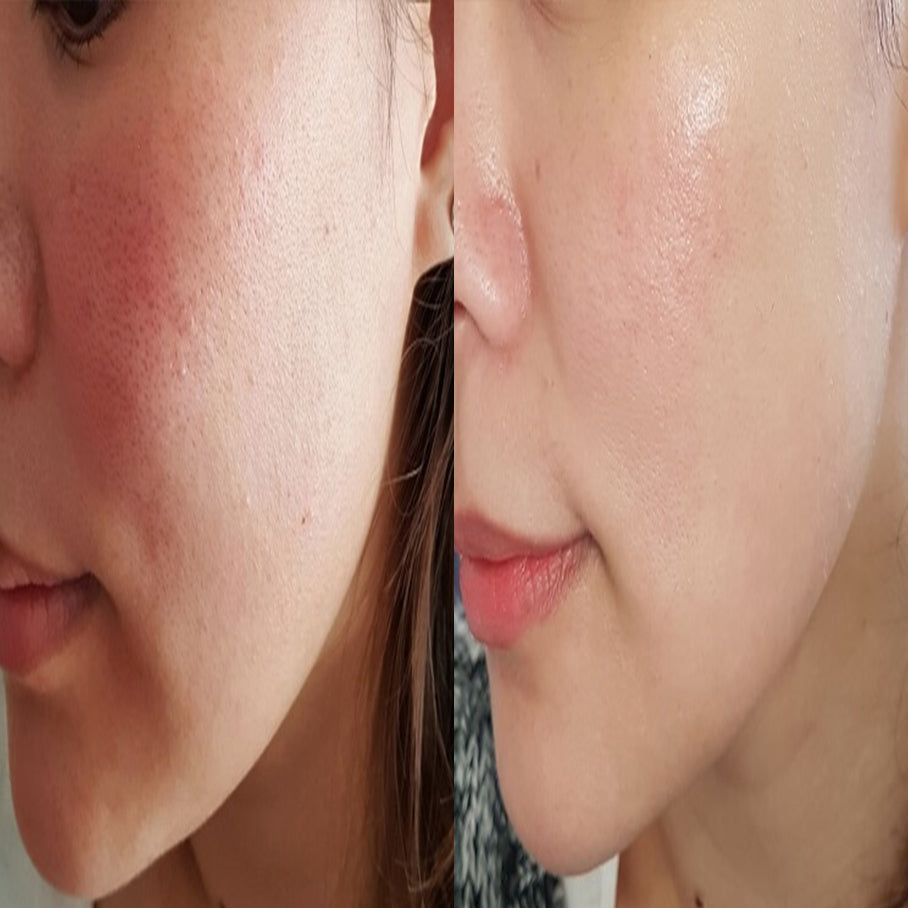 Mega Complexion Kit