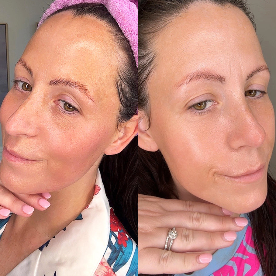 Anti-Ageing Set - For Normal Skin (Was Smoothest Anti-ageing kit)
