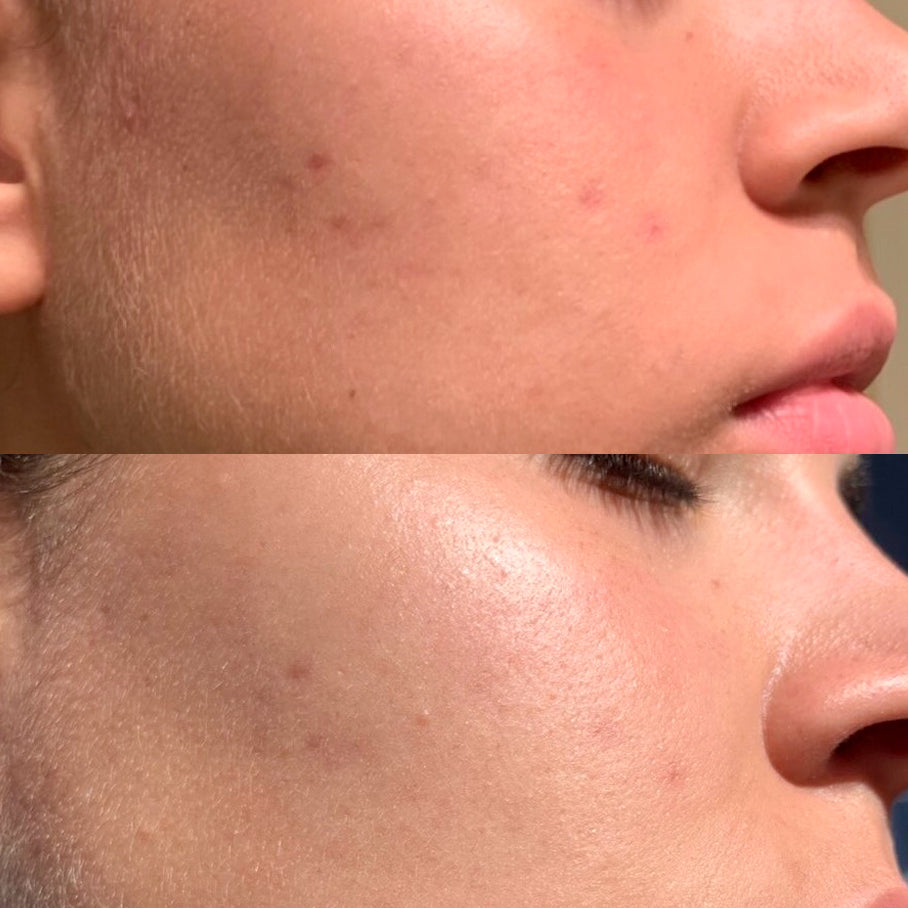 Mega Complexion Kit