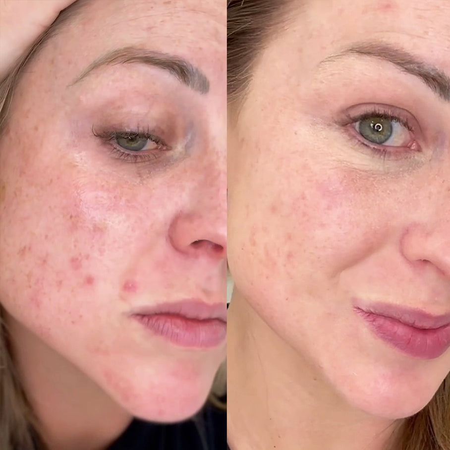 Smoothest Anti-Aging Mini Kit
