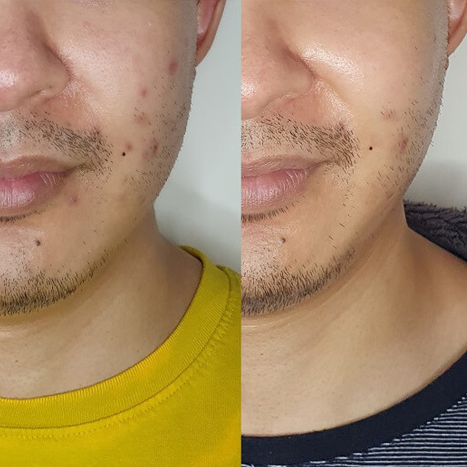 Smoothest Anti-aging Kit