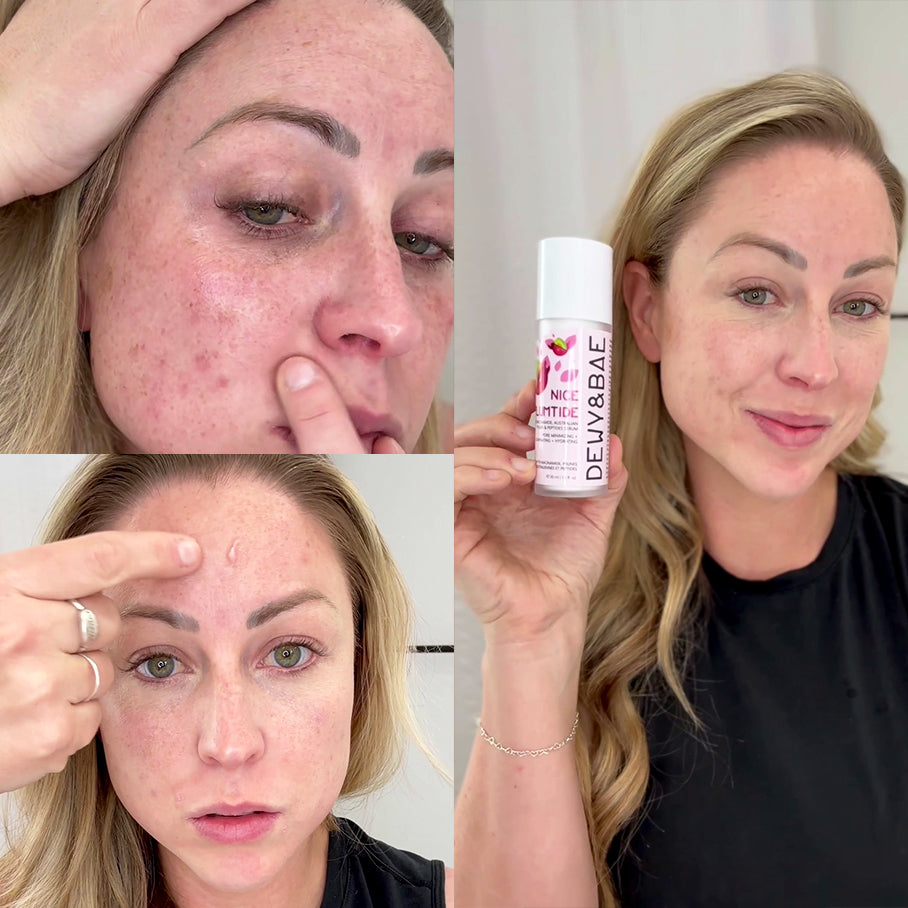 Ultra Dewy Kit