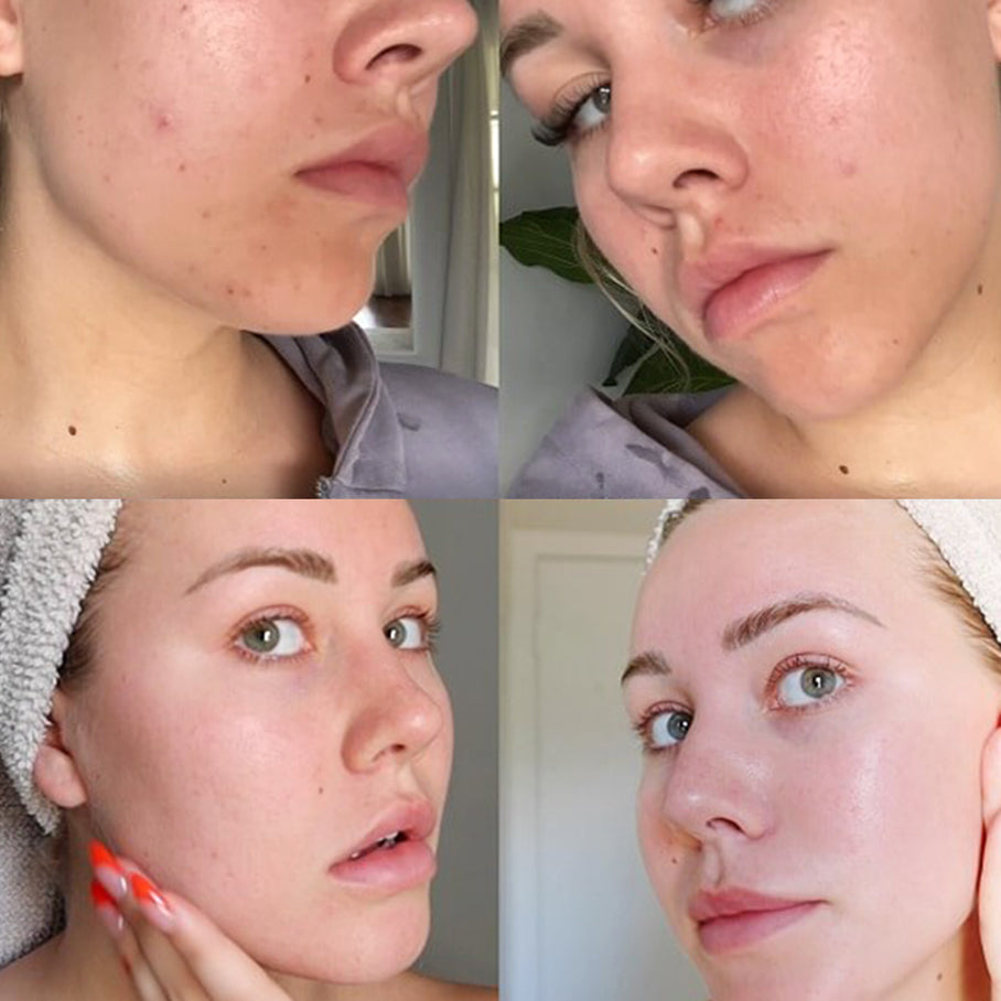 Mega Complexion Kit