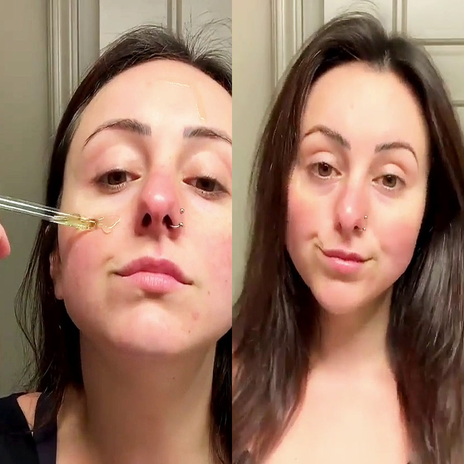 Ultra Dewy Kit