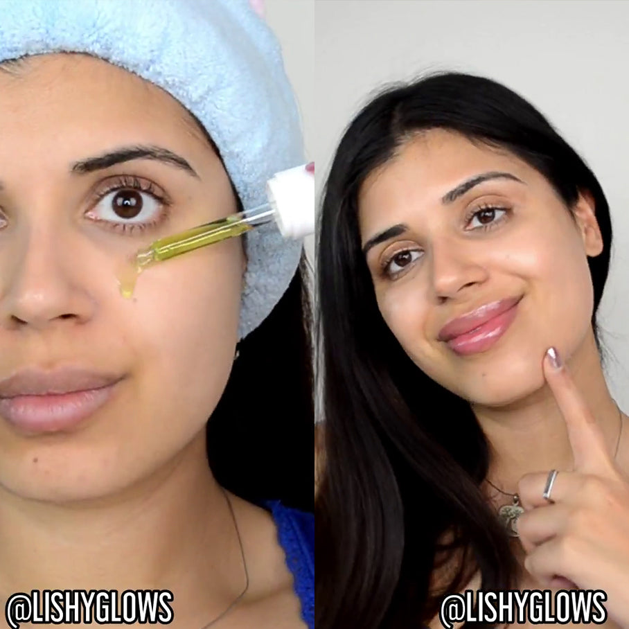 Mega Complexion Kit