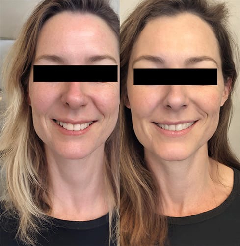 Anti-Ageing Set - For Normal Skin (Was Smoothest Anti-ageing kit)