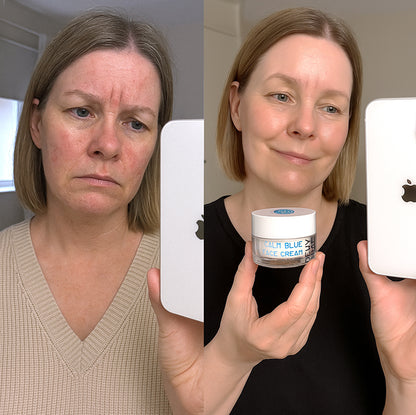 Calm Blue Face Cream | Soothing Moisturiser